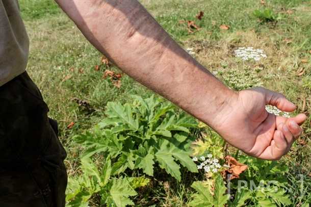 5. Взаимодействие с другими препаратами